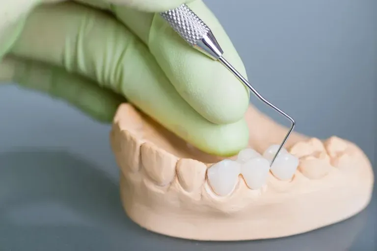Dentist adjusting a dental bridge on a jaw model with a handpiece
