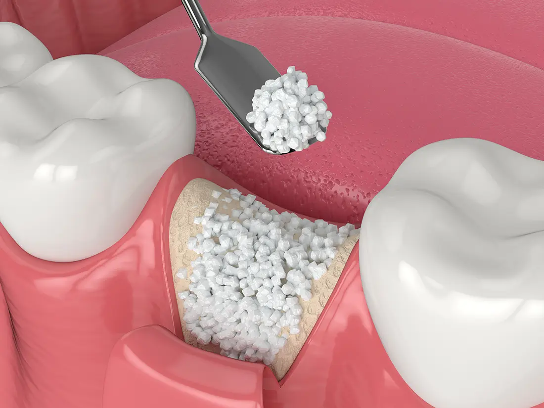Dentist examining gum health during an oral exam