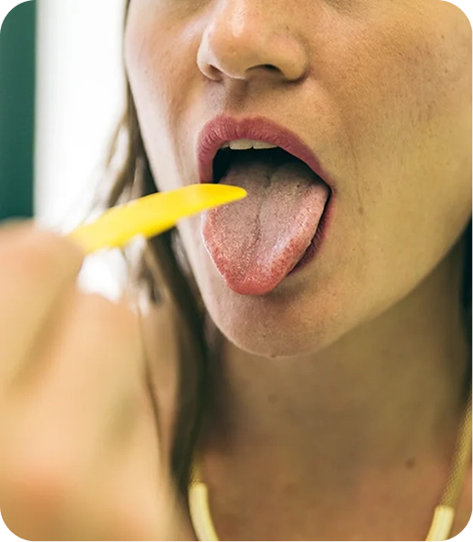 Patient with mouth open during an oral cancer screening using a tongue depressor