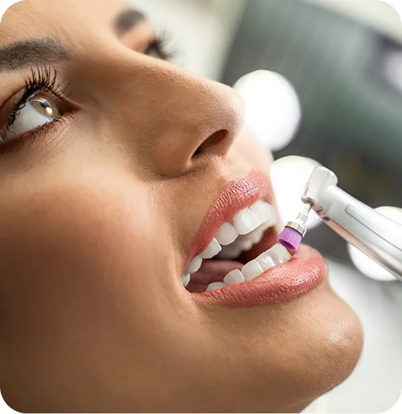 Hygienist performing a professional dental cleaning with a polishing handpiece