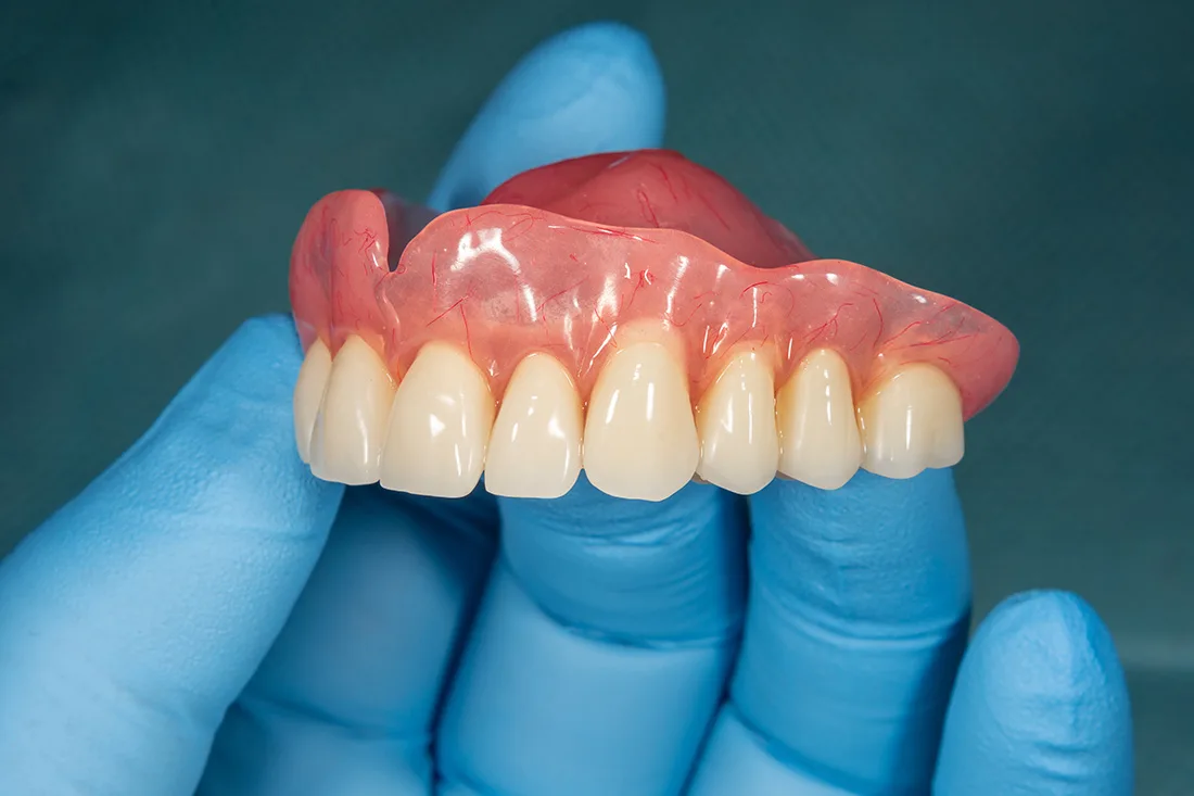 Gloved hand holding a set of upper dentures against a dark clinical background